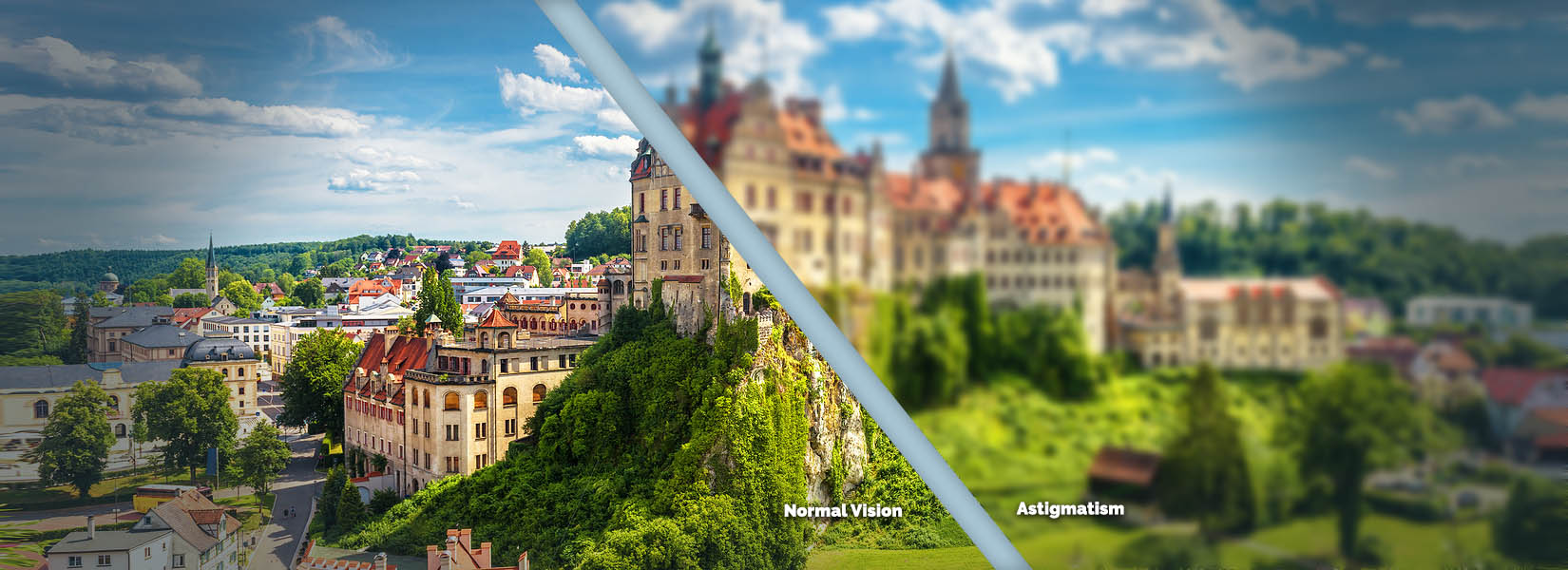 Astigmatism Treatment in Oakville