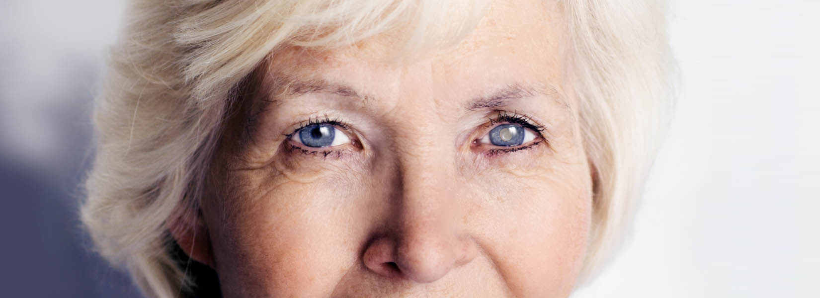 Cataract Surgery in Oakville