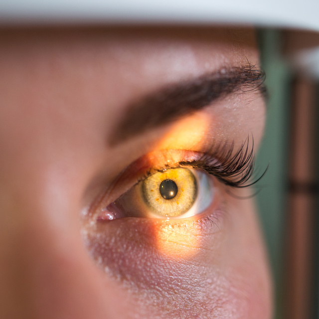 Vision Therapy in Oakville